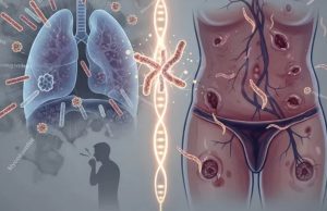 TUBERCULOSIS Y SÍFILIS: OTROS FRENTES DE ALARMA