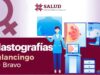Otorgará SSH y Gobierno de Tulancingo 50 mastografias gratuitas en la colonia Guadalupe