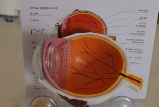 Desarrolla UPT sistema de bajo costo para mejorar imágenes de retina